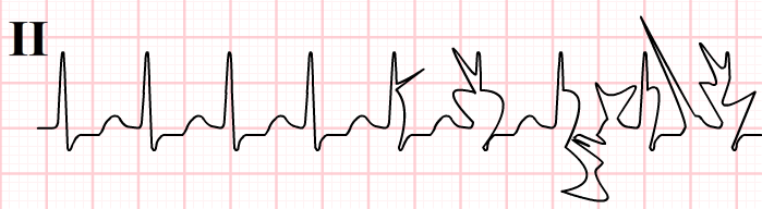 how to make an ekg machine